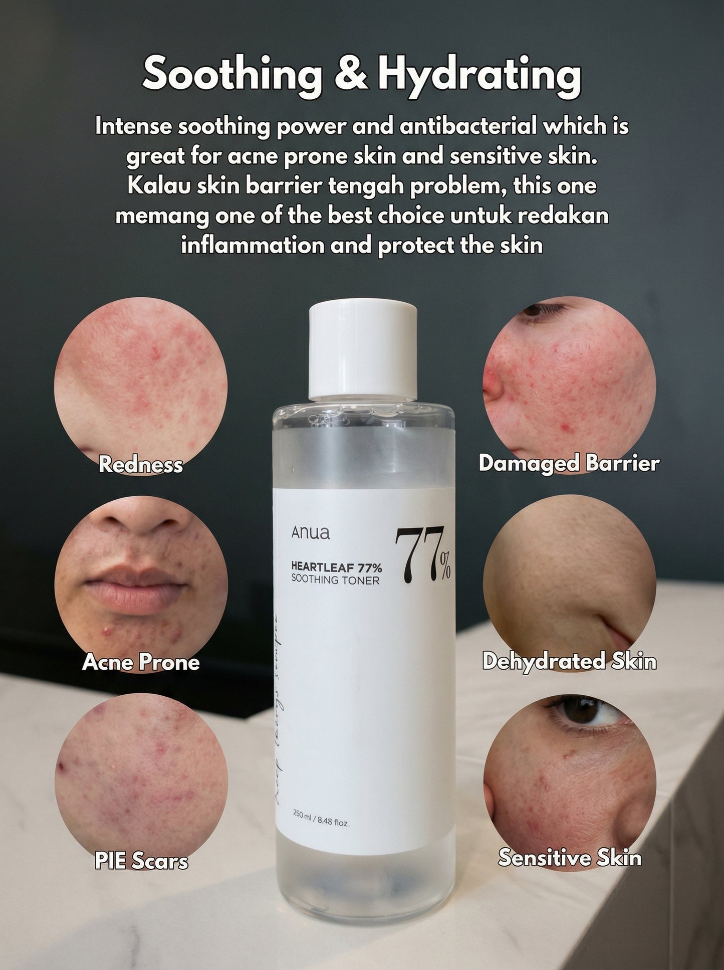 Anua Heartleaf 77% Soothing Toner ( New ) 250 ml / 40ml