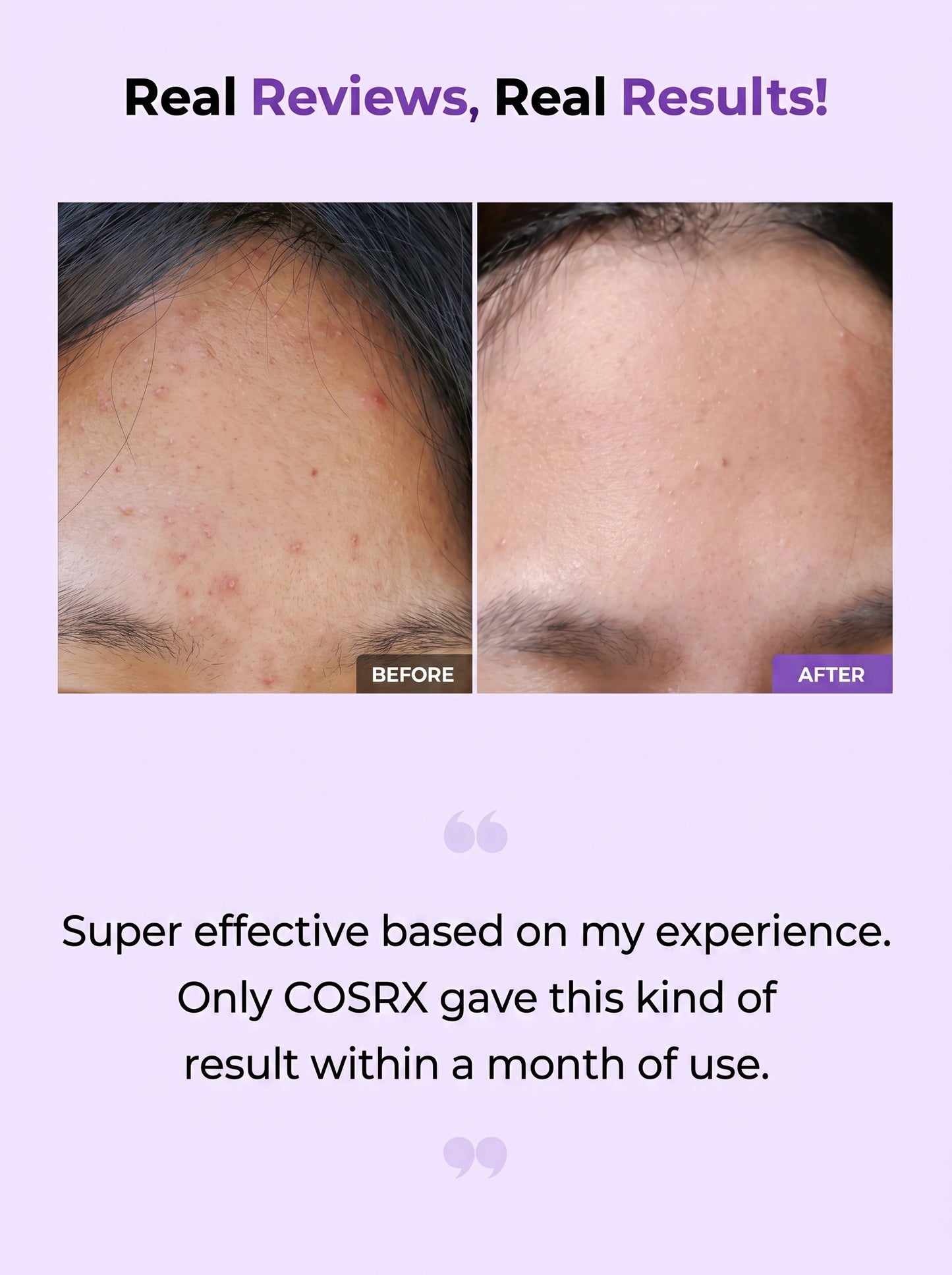Cosrx AHA/BHA Clarifying Treatment Toner